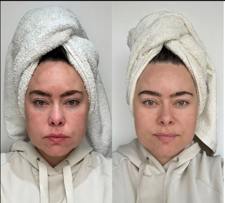 Real result in just 5 days