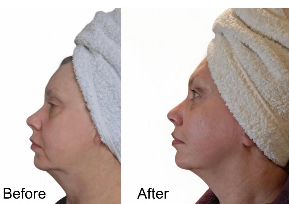 Real result in just 5 days!