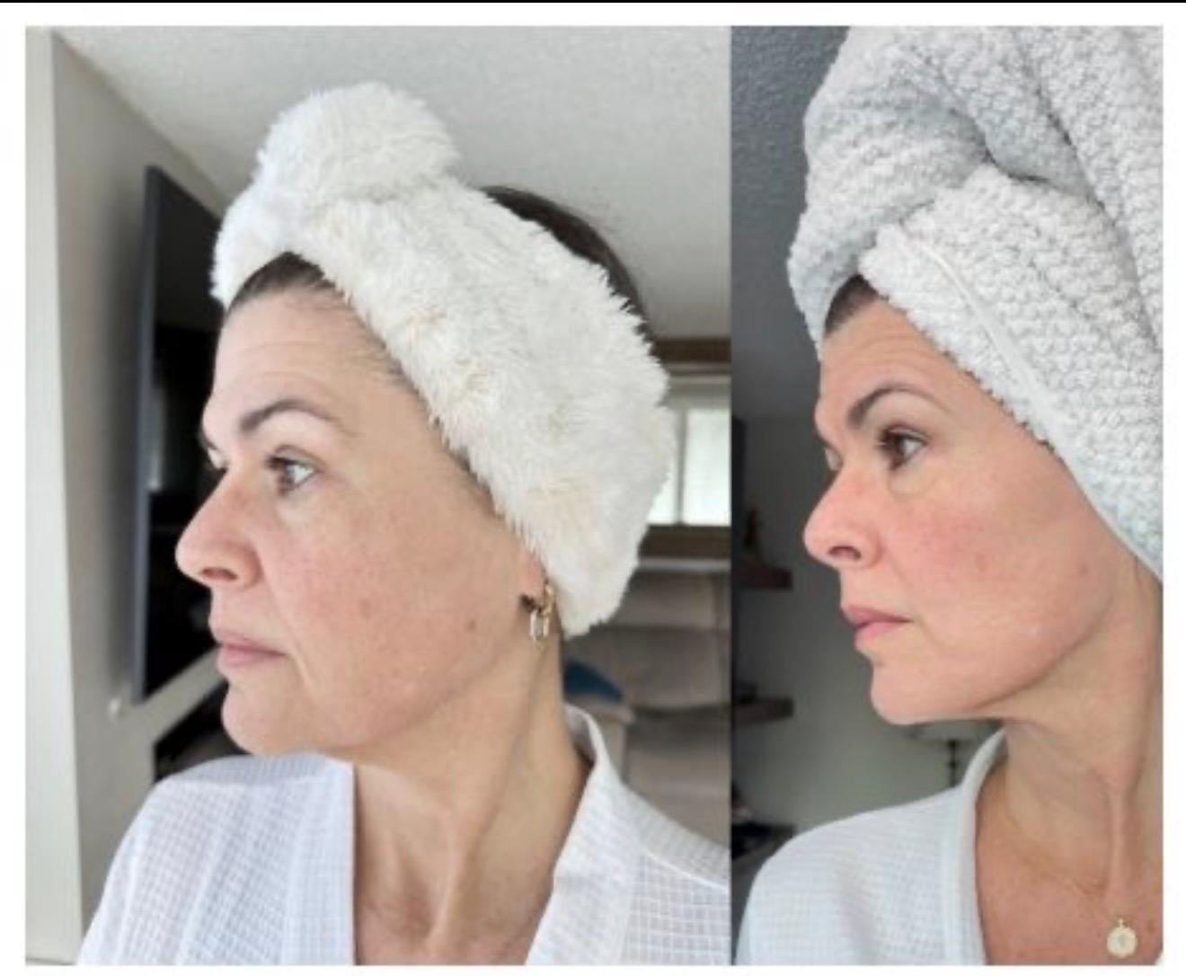 Real results in 5 days